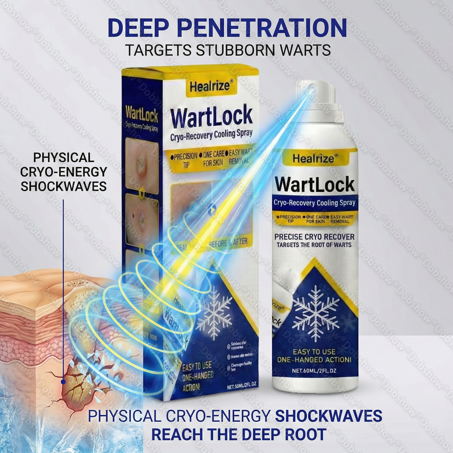 🏆Flash Sale⚡ 50K+ SOLD⏰✨|  Healrize® Wart Lock Cryo-Recovery Cooling Spray